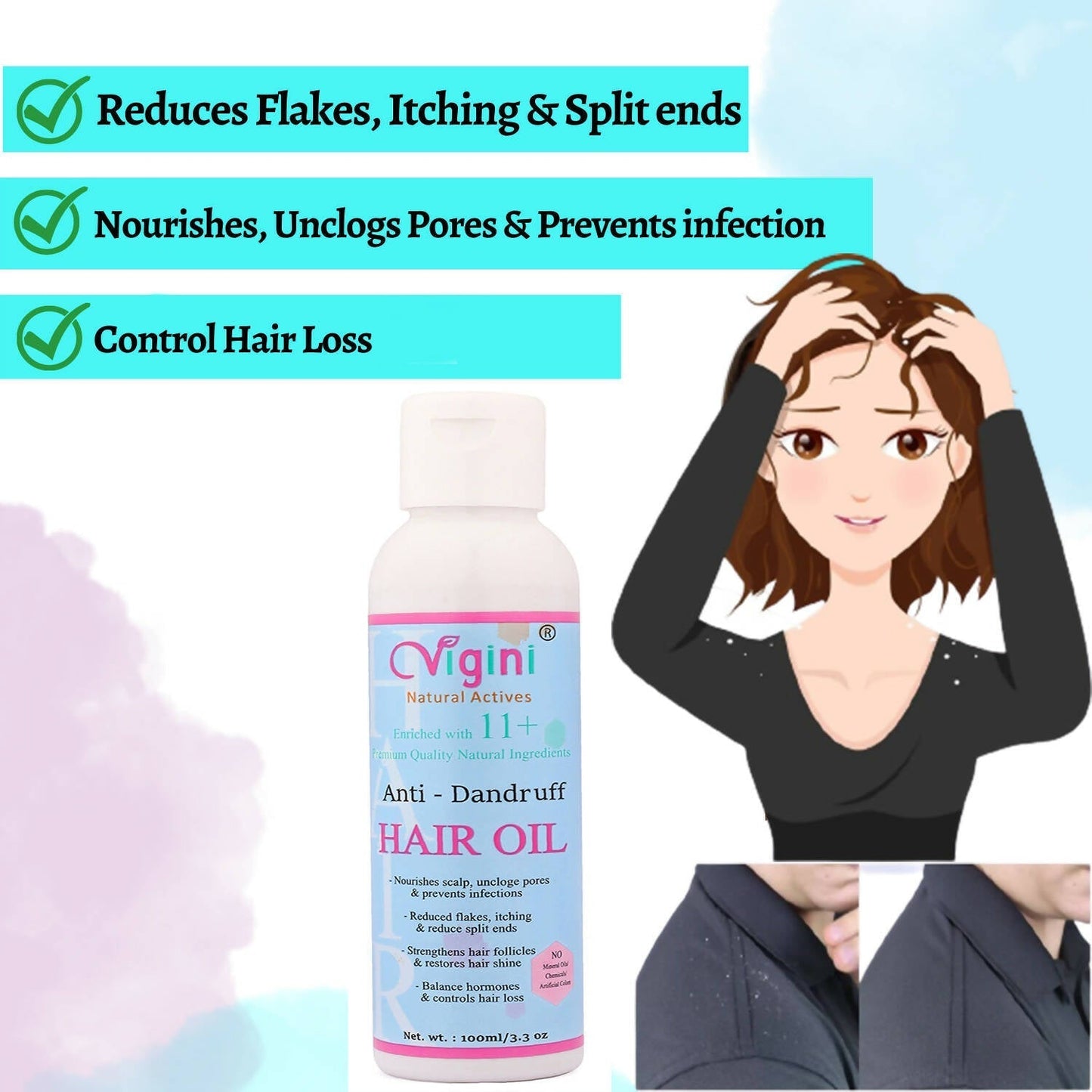 Vigini Anti Dandruff Itchy Scalp Hair Care Oil for Men Women Anti Hair Fall