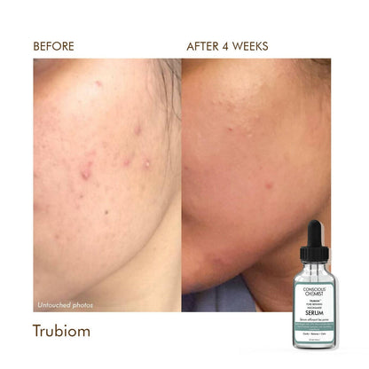 Conscious Chemist Trubiom Pore Refining Niacinamide Serum